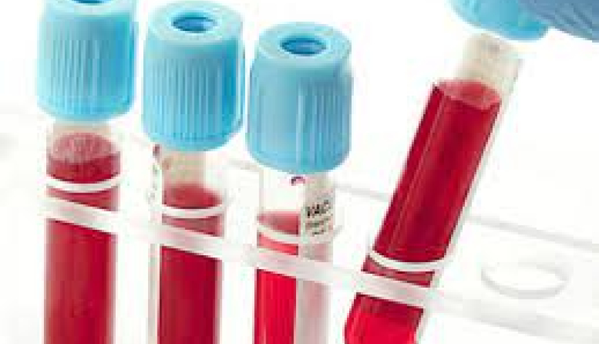 Klinik biokimya, klinik mikrobiologiya, laboratoriya analizləri, laboratoriya xidmətləri