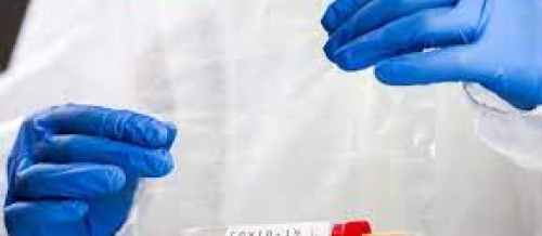 Laboratoriya analizləri, hormon analizləri, laboratoriya xidmətləri, tibbi laboratoriya