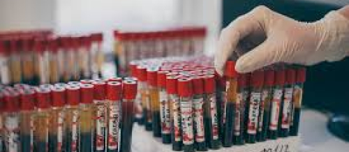 Laboratoriya analizləri, hormon analizləri, laboratoriya xidmətləri, tibbi laboratoriya