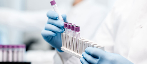 Analizlərin verilmə qaydası, Spermoqramma analizi, PZR, Qan analizi, Laborator müayinələr, Aşkarlayıcı müayinə