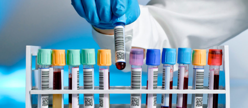 Sidiyin ümumi və biokimyəvi analizi, sidik analizi, Nəcis analizləri, Laborator testlər