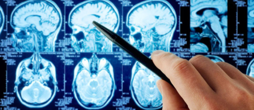 Nevrologiya, Nevroloji xəstəliklər, Baş ağrısı, demensiya, Yuxu pozğunluqları, əzələ xəstəlikləri, nevroloji müayinə