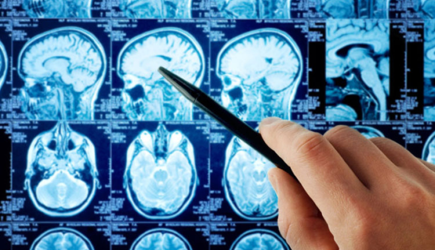 Nevrologiya, Nevroloji xəstəliklər, Baş ağrısı, demensiya, Yuxu pozğunluqları, əzələ xəstəlikləri, nevroloji müayinə