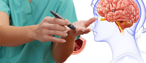 Nevroloji, Epilepsiya, Nevrologiya şöbəsi, Nevrologiya, Nevroloji Xidmətlər