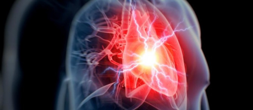 Ürək və damar xəstəlikləri, Anadangəlmə ürək qüsurları, Qazanılmış ürək qüsurları, Ürəyin işemik xəstəliyi