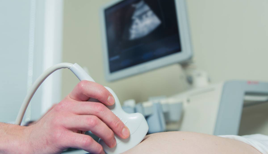 Doppleroqrafiya, Rəngli doppler müayinəsi, USM aparatlar, ultrasonoqrafiya nədir, Ultrasəs cihazı