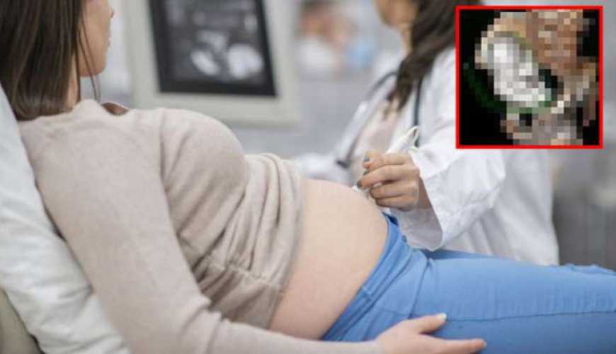 Tibbi ultrasəs nədir, Ultrasəs nə üçün istifadə olunur, Diaqnostik ultrasəs, Ümumi ultrasəs