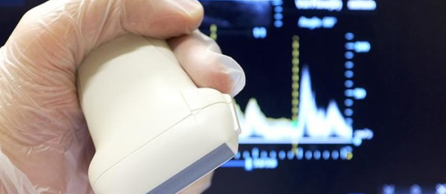 Doppler ultrasəs müayinəsi, Doppler USM-nin faydaları, Doppler USM, Doppler